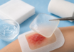A Guide to Hydrogel Wound Dressings