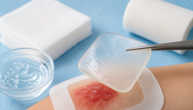 A Guide to Hydrogel Wound Dressings